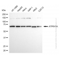KD-Validated ATP6V1A Rabbit mAb (20 μl)