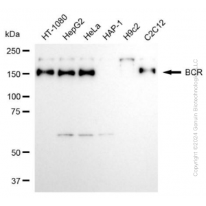 KD-Validated BCR Rabbit mAb (20 μl)