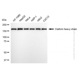 KD-Validated CLTC Rabbit mAb (20 μl)