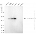 KD-Validated CKB Mouse mAb (20 μl)