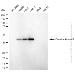 KD-Validated CKB Mouse mAb (20 μl)