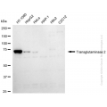 KD-Validated TGM2 Mouse mAb (20 μl)