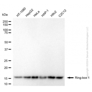 KD-Validated RBX1 Mouse mAb (20 μl)