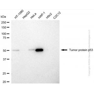 KD-Validated TP53 Rabbit pAb (20 μl)