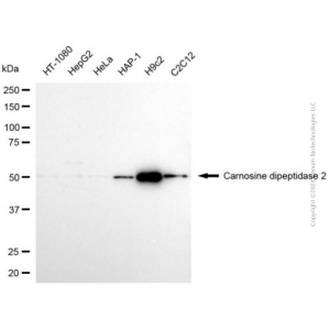 KD-Validated CNDP2 Mouse mAb (20 μl)