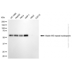 KD-Validated AAAS Mouse mAb (20 μl)