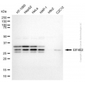 KD-Validated EIF4E2 Mouse mAb (20 μl)