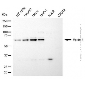 KD-Validated EPN2 Mouse mAb (20 μl)