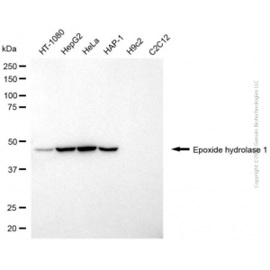 KD-Validated EPHX1 Mouse mAb (20 μl)