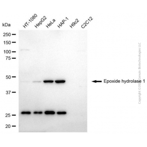 KD-Validated EPHX1 Mouse mAb (20 μl)