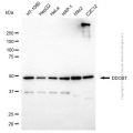 KD-Validated DDOST Mouse mAb (20 μl)
