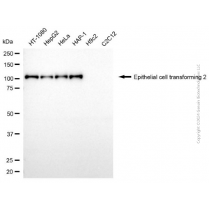KD-Validated ECT2 Mouse mAb (20 μl)