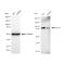 KD-Validated PCAF Rabbit mAb (20 μl)