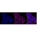 KD-Validated HER2 Rabbit mAb (20 μl)