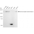 KD-Validated HER2 Rabbit mAb (20 μl)