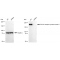 KD-Validated HER2 Rabbit mAb (20 μl)