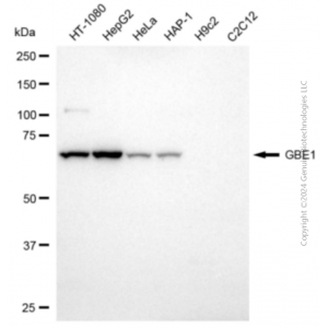 KD-Validated GBE1 Mouse mAb (20 μl)