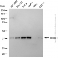 KD-Validated HIBCH Mouse mAb (20 μl)