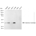 KD-Validated GALM Mouse mAb (20 μl)