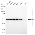 KD-Validated SSB Mouse mAb (20 μl)