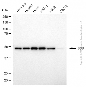 KD-Validated SSB Mouse mAb (20 μl)