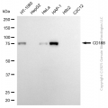 KD-Validated HMMR Rabbit mAb (20 μl)
