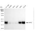 KD-Validated NPC2 Rabbit mAb (20 μl)