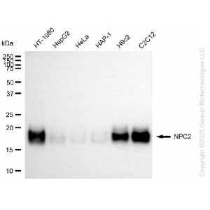KD-Validated NPC2 Rabbit mAb (20 μl)
