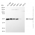 KD-Validated PDLIM7 Rabbit mAb (20 μl)
