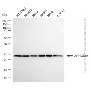 KD-Validated ARHGDIA Rabbit mAb (20 μl)