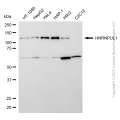 KD-Validated HNRNPUL1 Rabbit mAb (20 μl)