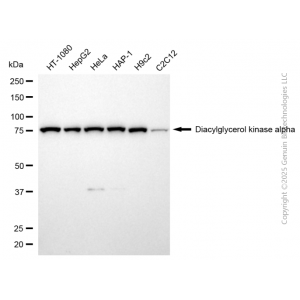 KD-Validated DGKA Rabbit mAb (20 μl)