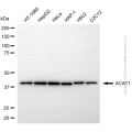 KD-Validated ACAT1 Rabbit pAb (20 μl)