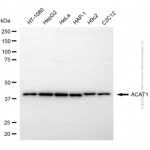 KD-Validated ACAT1 Rabbit pAb (20 μl)