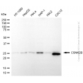 KD-Validated CSNK2B Rabbit pAb (20 μl)
