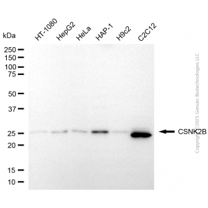KD-Validated CSNK2B Rabbit pAb (20 μl)
