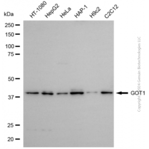 KD-Validated GOT1 Rabbit pAb (20 μl)