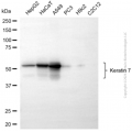 KD-Validated KRT7 Rabbit pAb (20 μl)
