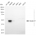 KD-Validated KRT17 Rabbit pAb (20 μl)