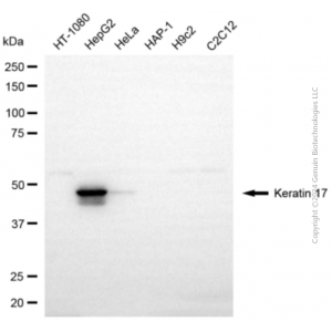 KD-Validated KRT17 Rabbit pAb (20 μl)