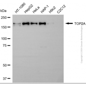 KD-Validated TOP2A Rabbit pAb (20 μl)
