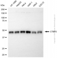 KD-Validated CTBP2 Rabbit pAb (20 μl)