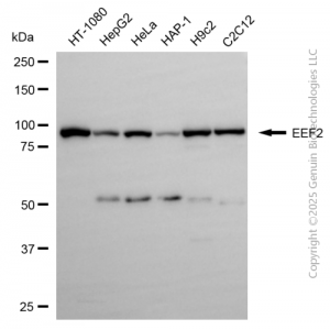 KD-Validated EEF2 Rabbit pAb (20 μl)