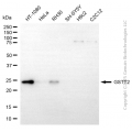 KD-Validated GSTT2 Mouse mAb (20 μl)