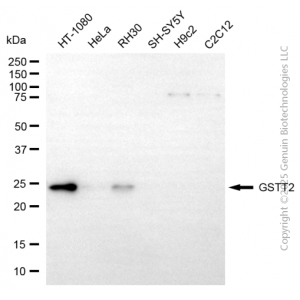 KD-Validated GSTT2 Mouse mAb (20 μl)