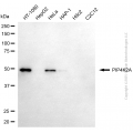KD-Validated PIP4K2A Mouse mAb (20 μl)