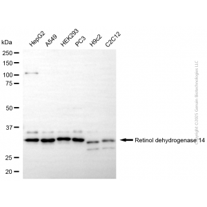 KD-Validated RDH14 Mouse mAb (20 μl)