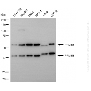 KD-Validated PPM1B Mouse mAb (20 μl)