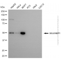 KD-Validated SELENBP1 Mouse mAb (20 μl)