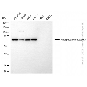 KD-Validated PGM3 Mouse mAb (20 μl)